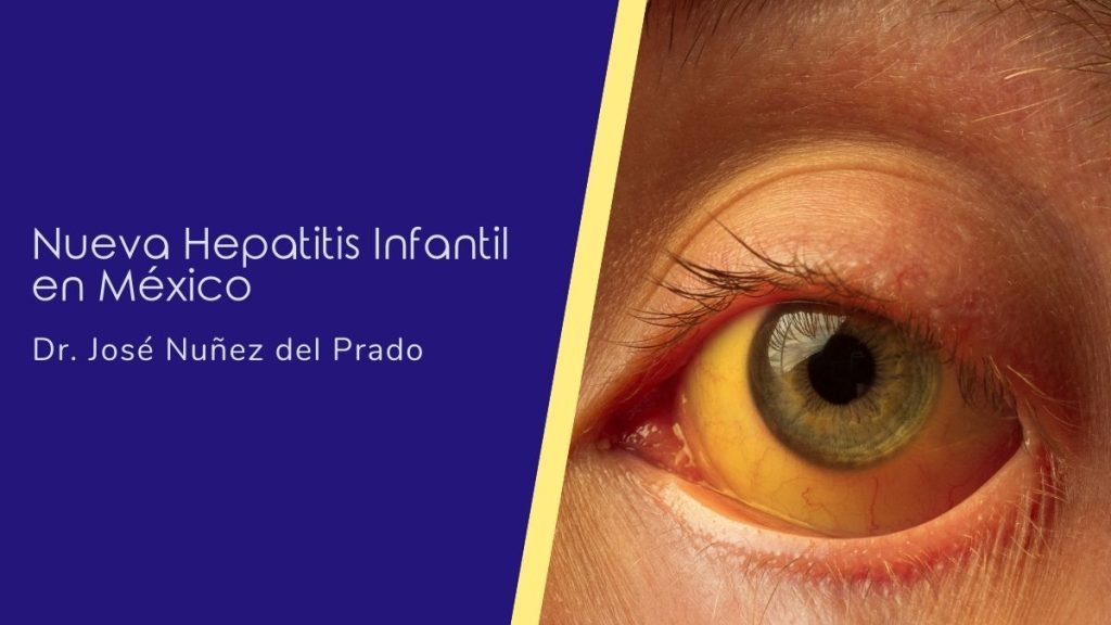 Nueva Hepatitis Infantil en México